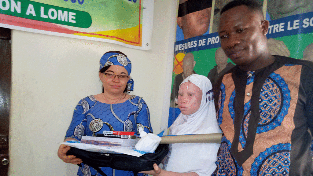 Lancement du projet d’appui à la scolarisation des personnes atteintes d’albinisme au Togo
