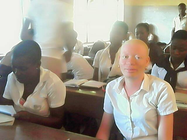 Appui à la scolarisation des personnes atteintes d’albinisme au Togo