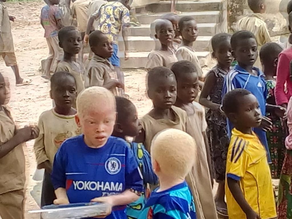Agir pour l’éducation inclusive des personnes atteintes d’albinisme au Togo