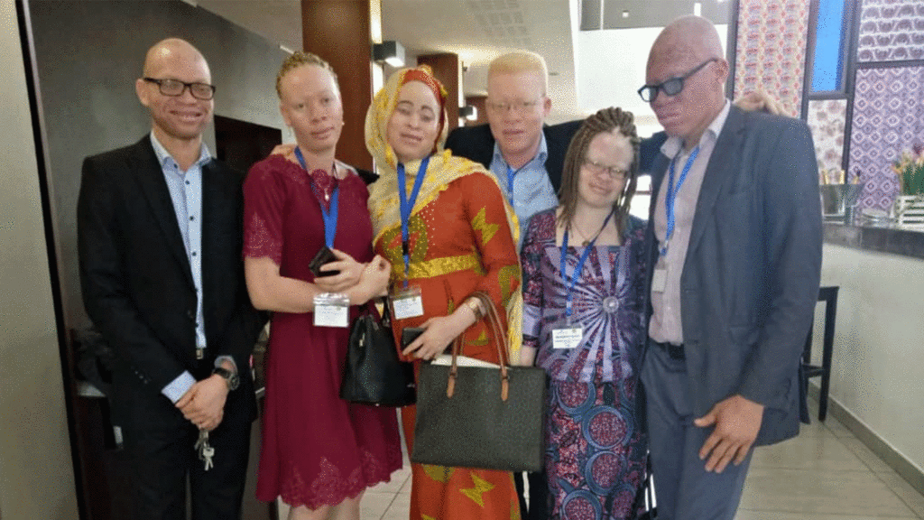 Lutte contre l’exclusion sociale des personnes atteintes d’albinisme au Togo