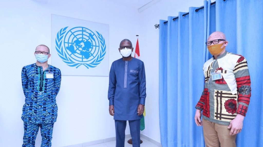 Togo : le plaidoyer pour l’albinisme bénéficie d’un soutien de taille