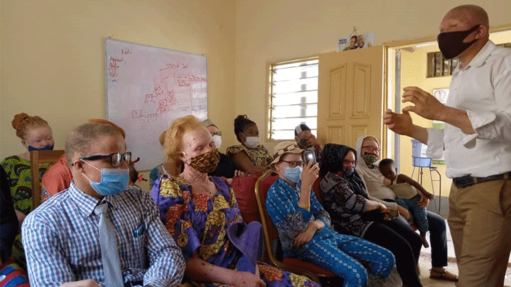 La promotion de l’entrepreneuriat des personnes atteintes d’albinisme au Togo