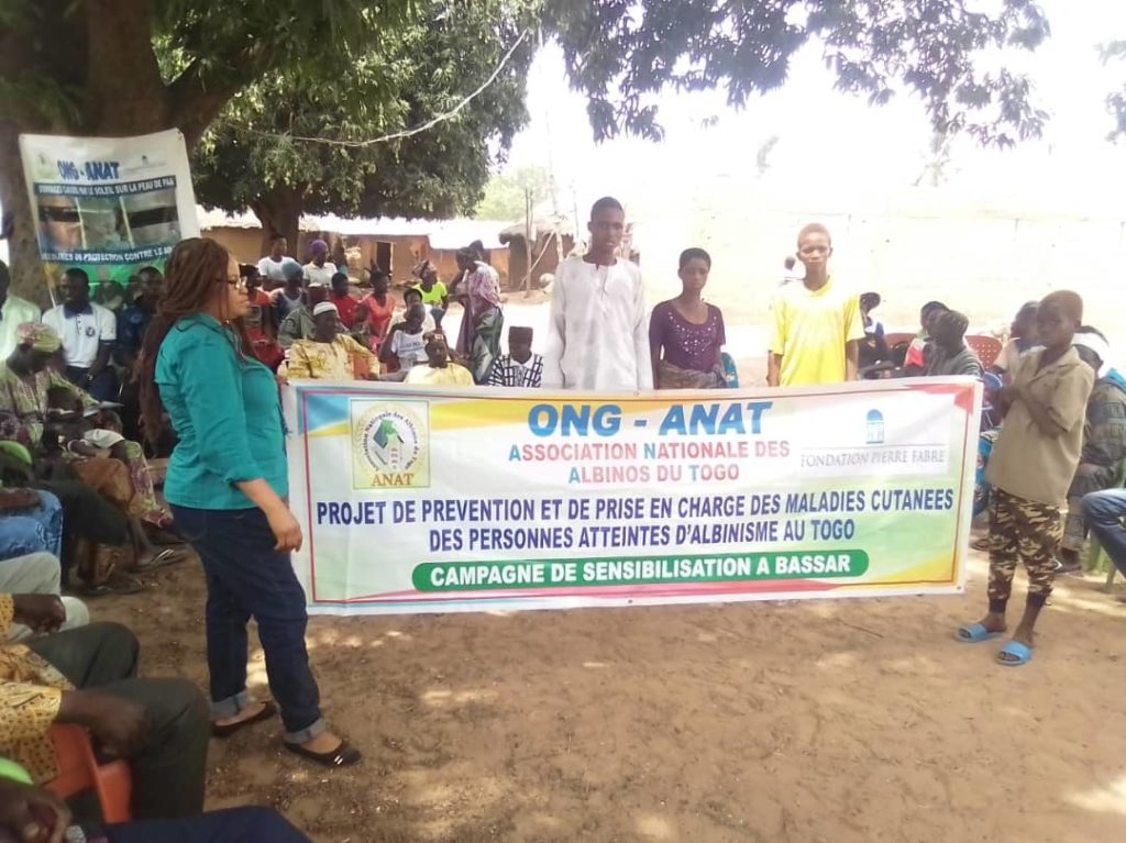 Les populations rurales du Togo sensibilisées sur l’albinisme
