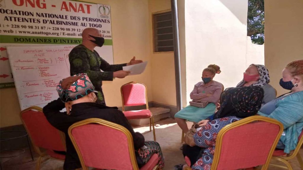 Soutien à l’entrepreneuriat des femmes atteintes d’albinisme au Togo
