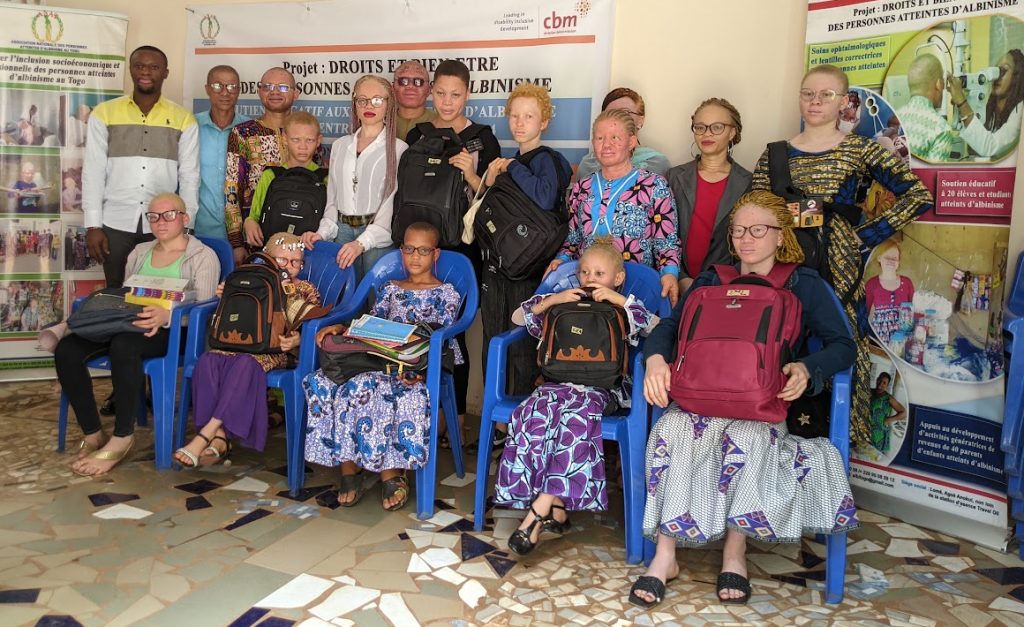 Education inclusive au Togo : L'engament fort de l'ANAT en faveur des personnes atteintes d'albinisme au Togo